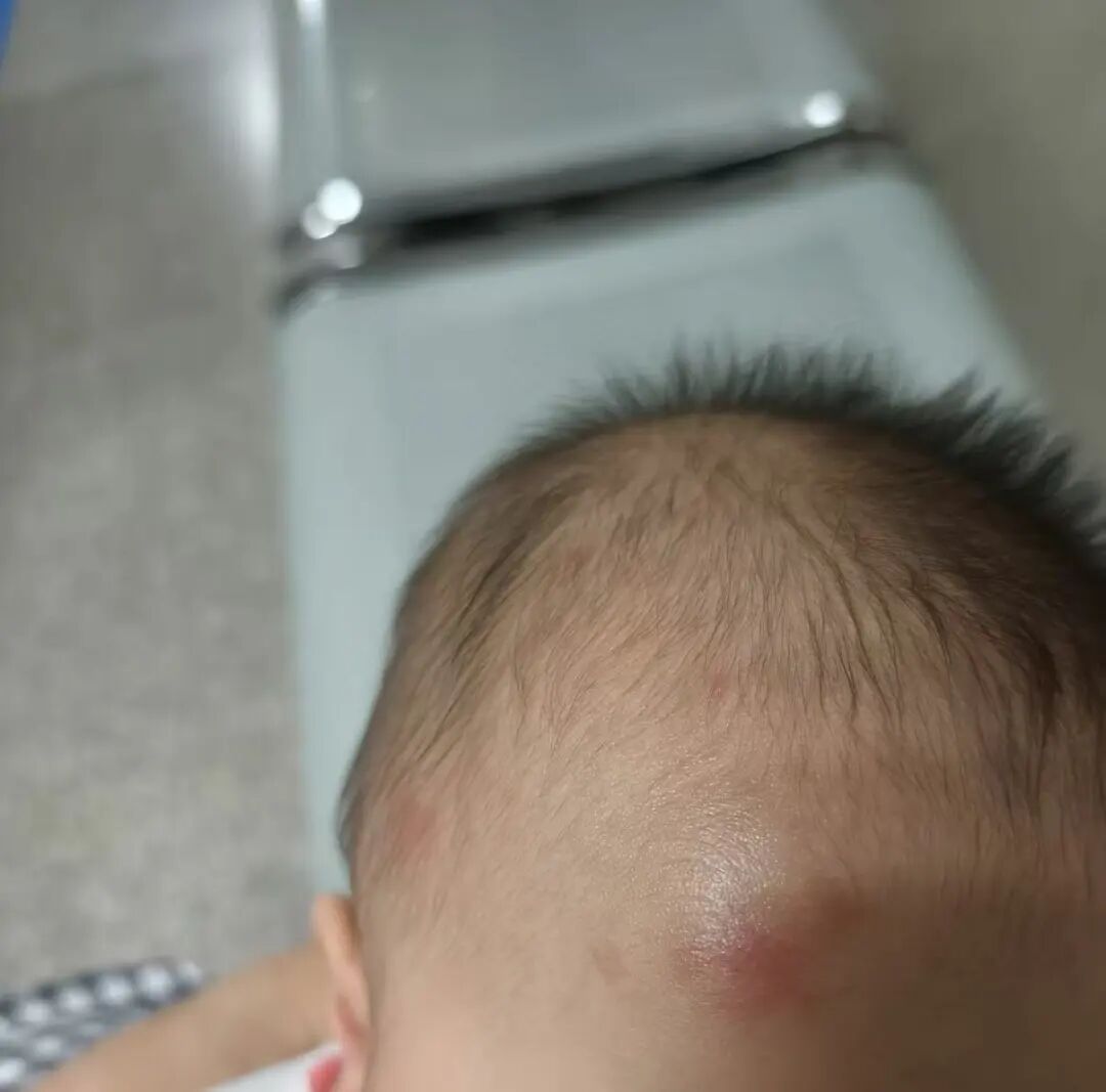 宝妈怀抱婴儿在扶梯上，被背后滑下玩具车铲倒，孩子脱手飞出头部多处受伤！