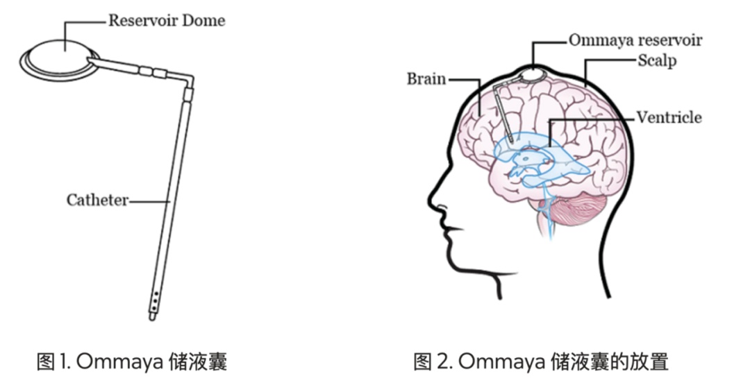 36岁男子感染超级细菌，脑脊液凝固成“果冻”！医生：几乎对所有常用抗生素耐药……