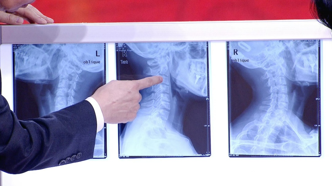 每天半小时，女子肾破了！身体这些“禁区”别乱碰