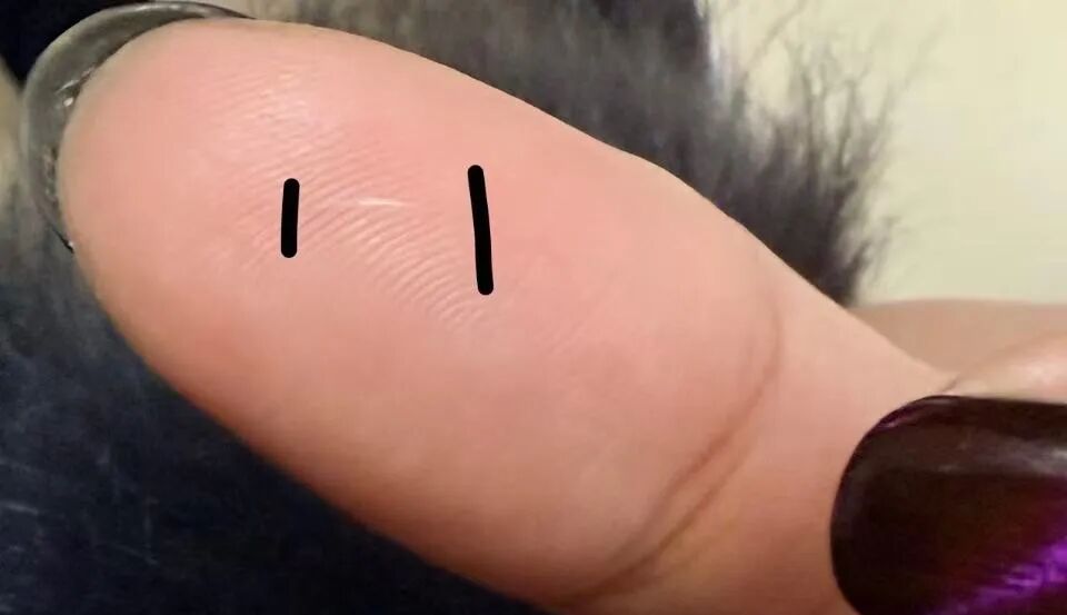 又有网友中招！很多人对它又爱又恨