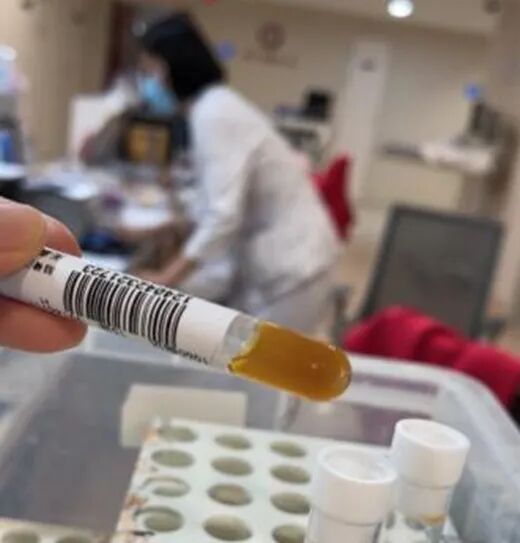 男子高烧不退，脑脊液浑浊得像“果冻”！死亡率极高