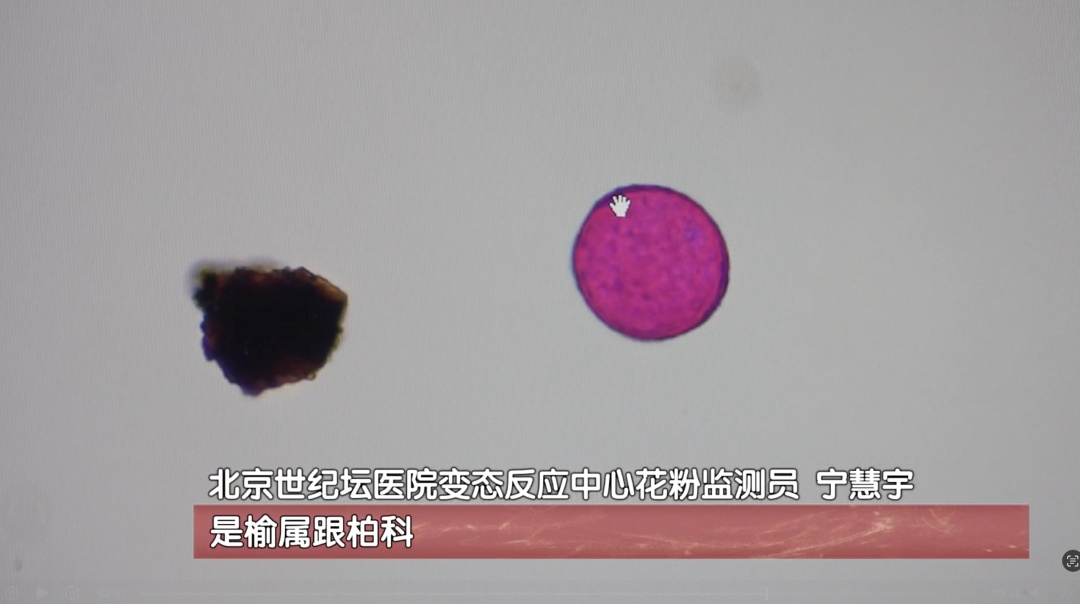 北京人注意了：花粉高峰提前到！打喷嚏、眼痒别大意