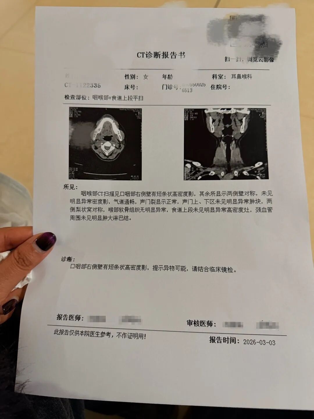 “一口三百块”：网友吐槽卡喉经历