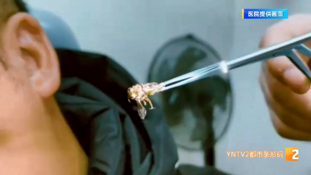 不停蠕动!嗡嗡作响!昆明一男子赏花时,蜜蜂钻进左耳…… 不停蠕动!嗡嗡作响!昆明一男子赏花时,蜜蜂钻进左耳……