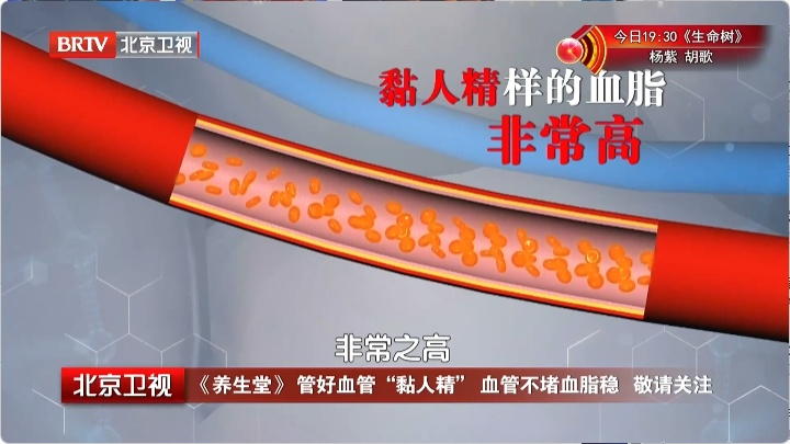 这样吃油，血管会越来越干净，帮你赶跑“坏”胆固醇，血脂稳稳降