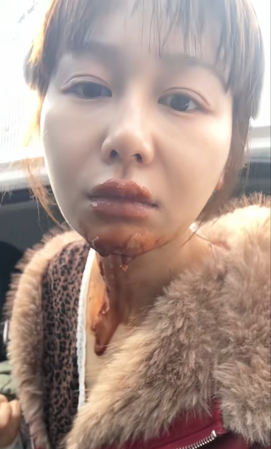 生日模仿“网红拍照法”，女演员向插着蜡烛的蛋糕喷吐含酒精液体，差点毁容