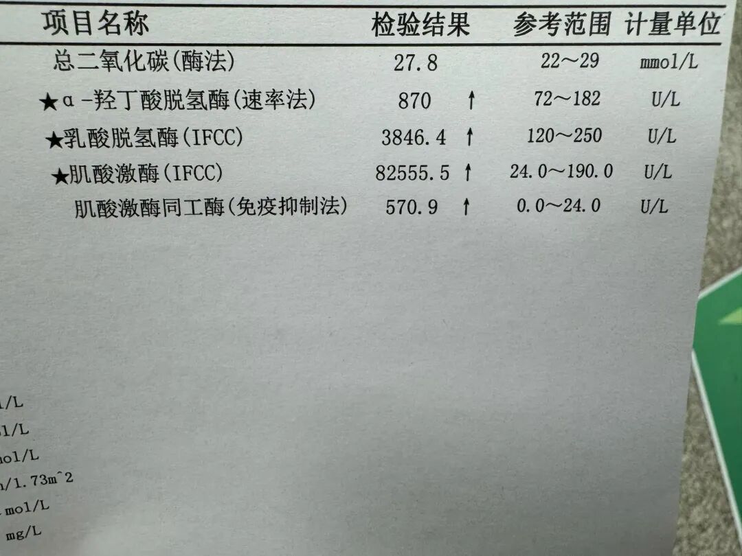 连做300个深蹲，主播突发意外！
