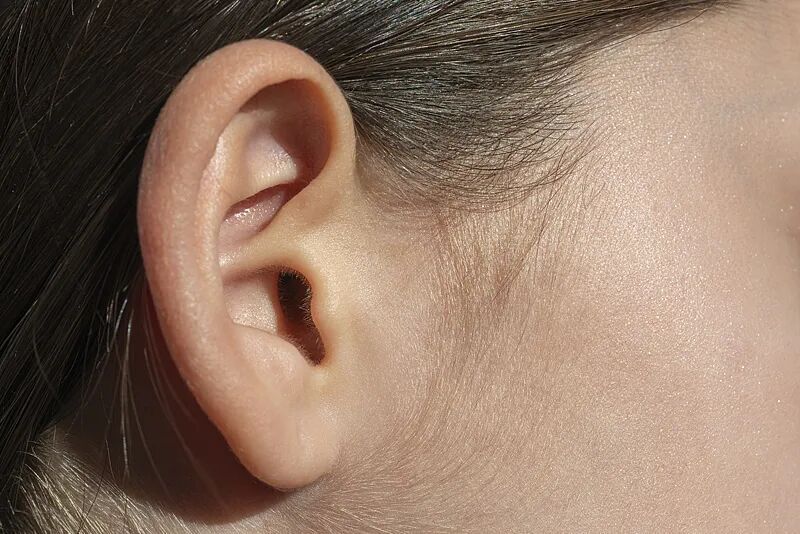 20岁小伙长期佩戴骨传导耳机确诊“噪声性耳聋” ，医生提醒