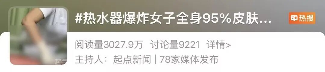 突然爆炸,女子全身95%皮肤重度烫伤!卫生间里的这些细节很多人忽视 突然爆炸,女子全身95%皮肤重度烫伤!卫生间里的这些细节很多人忽视