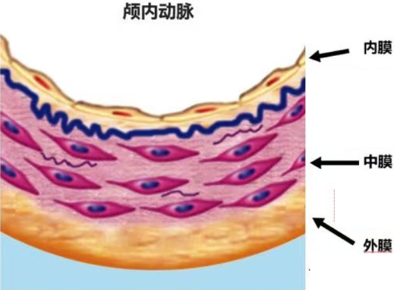 男子陪妻子练车被“甩”出脑梗，医生：他坐副驾没系安全带