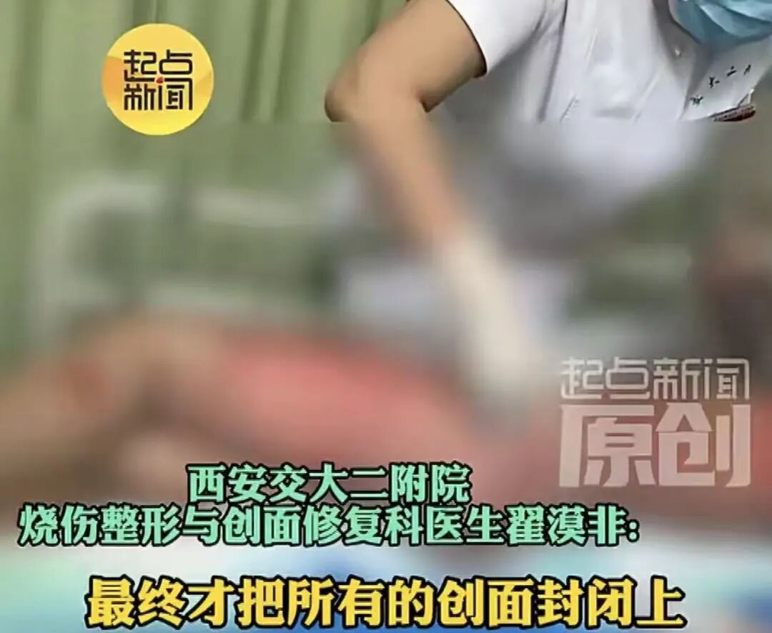 突然爆炸,女子全身95%皮肤重度烫伤!卫生间里的这些细节很多人忽视 突然爆炸,女子全身95%皮肤重度烫伤!卫生间里的这些细节很多人忽视