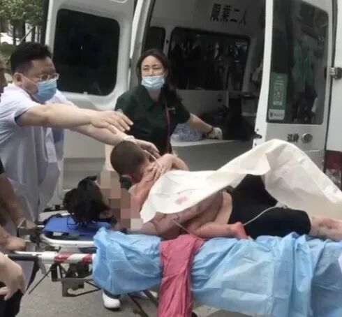 突然爆炸,女子全身95%皮肤重度烫伤!卫生间里的这些细节很多人忽视 突然爆炸,女子全身95%皮肤重度烫伤!卫生间里的这些细节很多人忽视