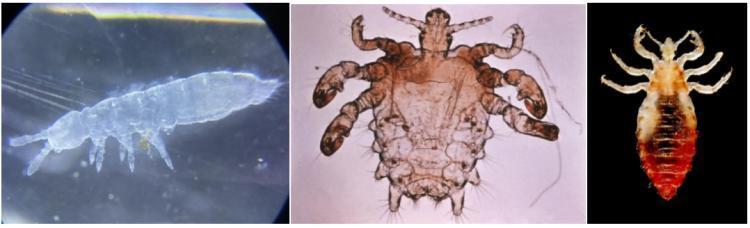 上厕所惊现“白色蠕虫”!义乌大妈吓坏直奔医院,结果让人大跌眼镜 上厕所惊现“白色蠕虫”!义乌大妈吓坏直奔医院,结果让人大跌眼镜