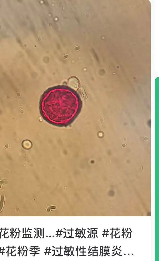 注意关窗!易感人群近期请注意戴口罩 注意关窗!易感人群近期请注意戴口罩