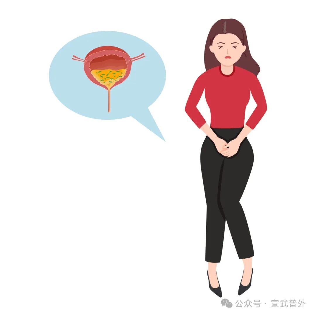 小心！酒后憋尿，膀胱可能“炸毛”