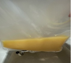 18岁少年血脂超标61倍，身上密密麻麻长满红色丘疹，连医生都震惊了……