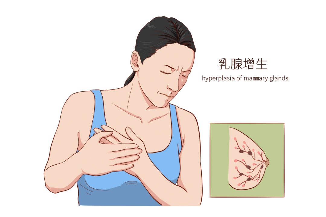 乳腺增生到底用不用治？身体出现这5个信号，立刻去检查！