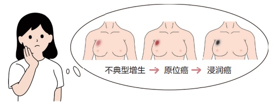 乳腺增生到底用不用治？身体出现这5个信号，立刻去检查！