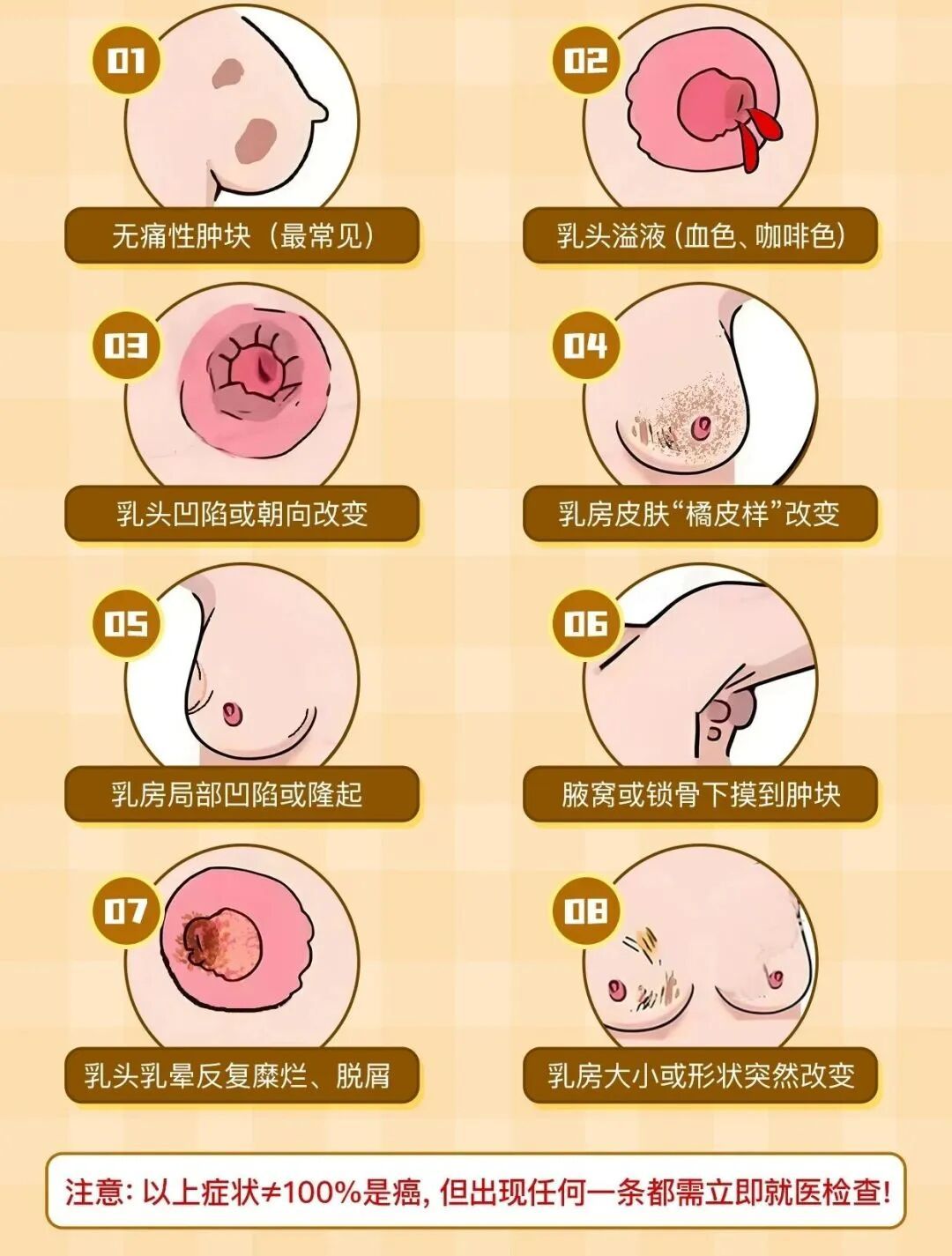 乳腺增生到底用不用治？身体出现这5个信号，立刻去检查！