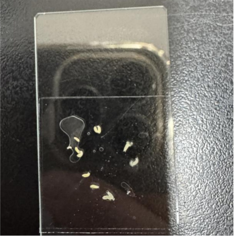 上厕所惊现“白色蠕虫”!义乌大妈吓坏直奔医院,结果让人大跌眼镜 上厕所惊现“白色蠕虫”!义乌大妈吓坏直奔医院,结果让人大跌眼镜