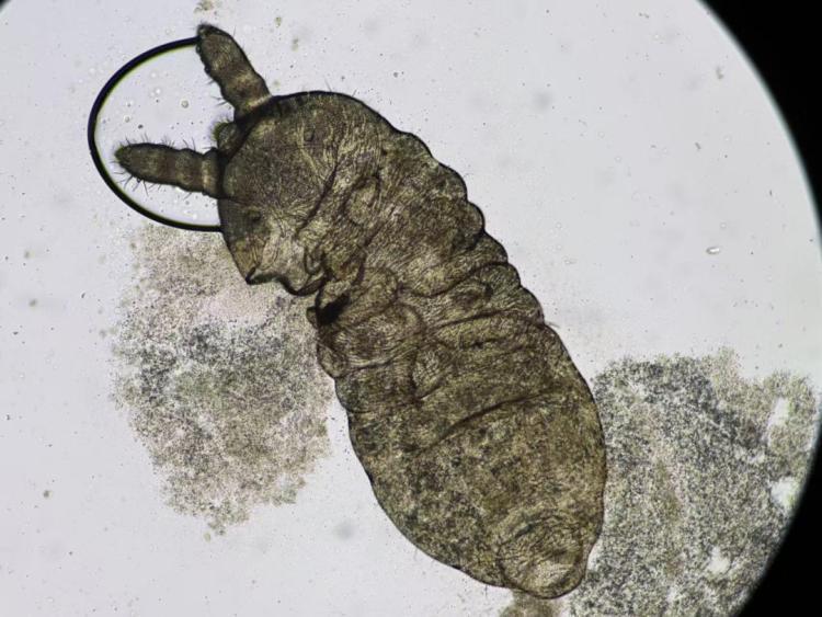 上厕所惊现“白色蠕虫”!义乌大妈吓坏直奔医院,结果让人大跌眼镜 上厕所惊现“白色蠕虫”!义乌大妈吓坏直奔医院,结果让人大跌眼镜