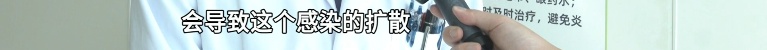男子将眼旁麦粒肿当痘痘挤，眼睛差点“报废”