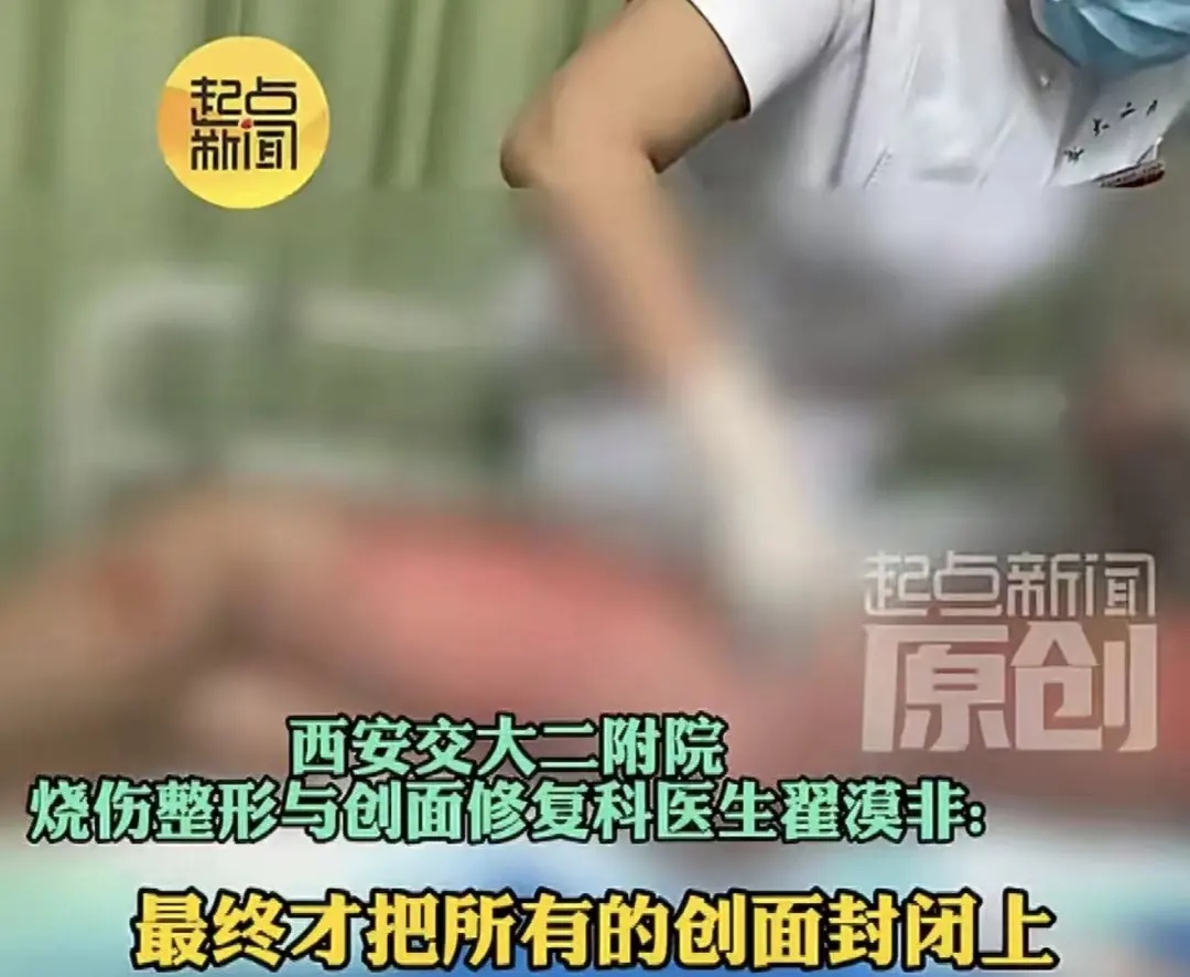 女子洗澡时突发意外，全身95%皮肤重度烫伤，并非个例，卫生间里很多人忽视