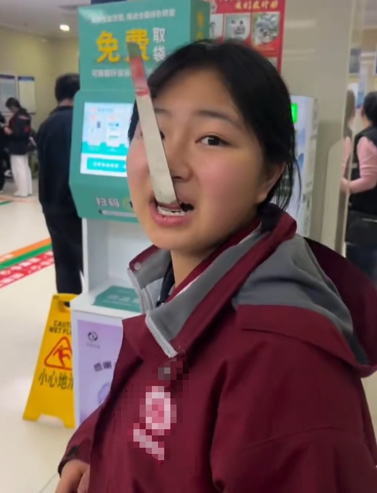 西安女孩吃酸奶太急勺子卡牙里凌晨就医，家属：看到医生拿出粗钢板，她把勺子薅出来了