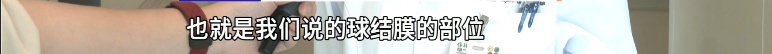 男子将眼旁麦粒肿当痘痘挤，眼睛差点“报废”