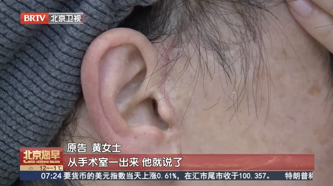 “真的特别闹心”！女子轻信医美宣传“顶尖医师”，术后怒将医院告上法庭