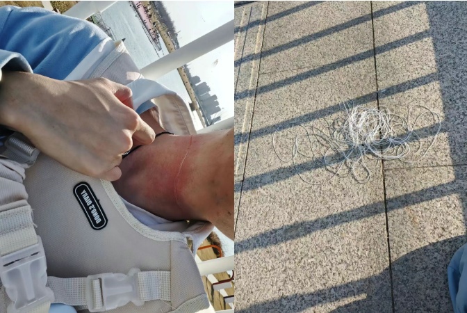 男子骑车过桥遭“割脸”！风筝线又伤人