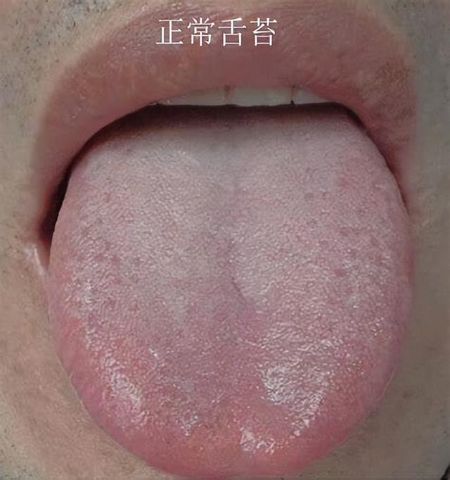 一个刷牙时容易漏掉的细节，可能导致口臭！99%的人都“中枪”了