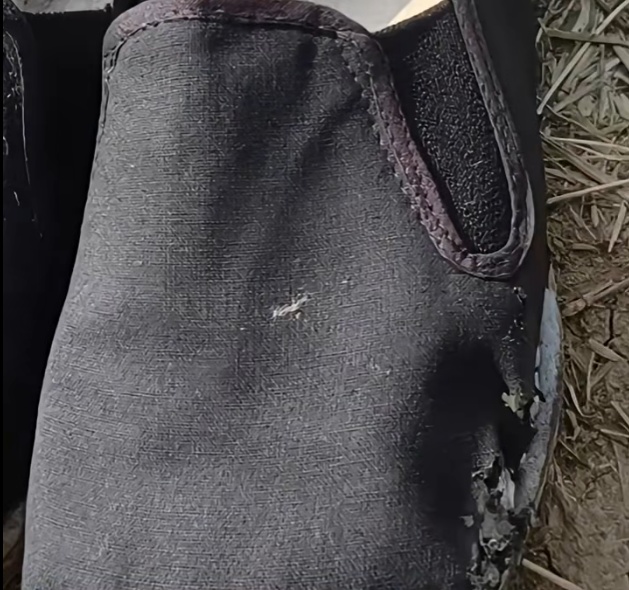 男子钓个鱼却惨遭截肢!消防提醒:钓鱼爱好者小心这根“线” 男子钓个鱼却惨遭截肢!消防提醒:钓鱼爱好者小心这根“线”