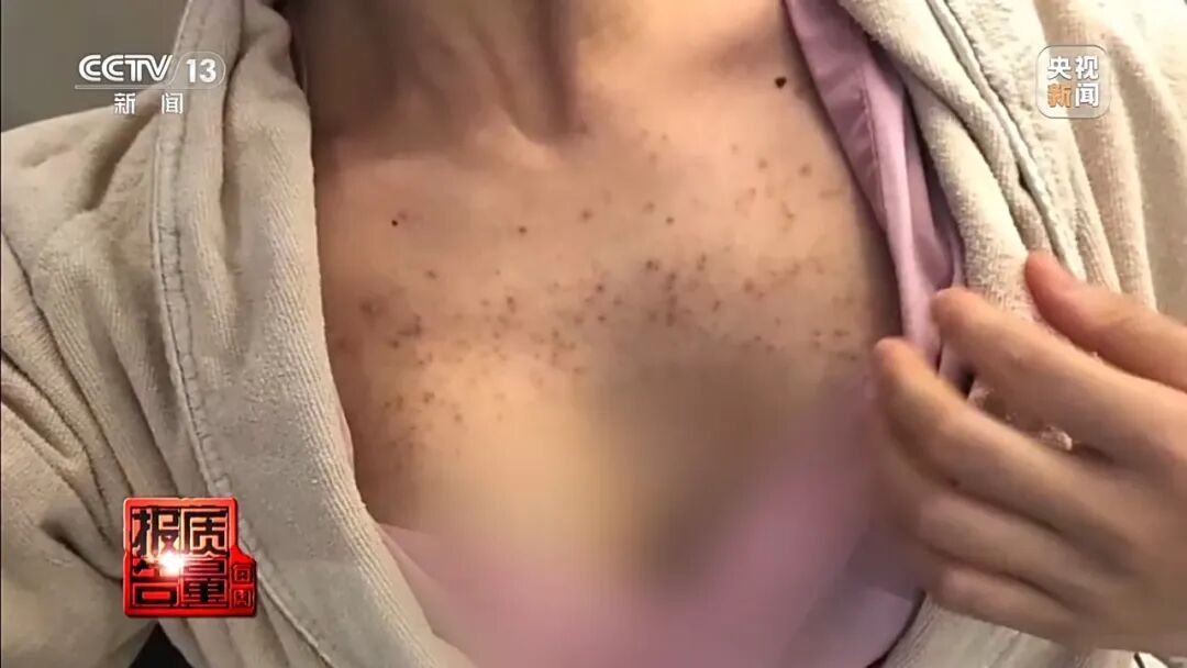 健身女孩长出喉结！部分“增肌神药”实为兽药