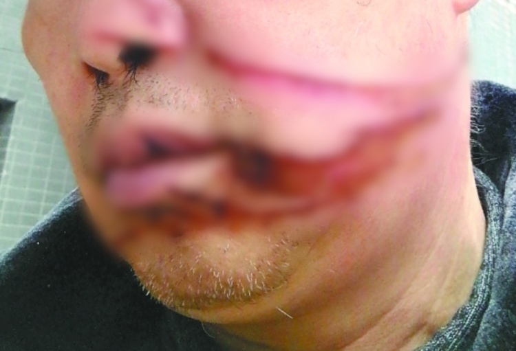 空中飘来一把“刀”！近期警惕这个“凶器”