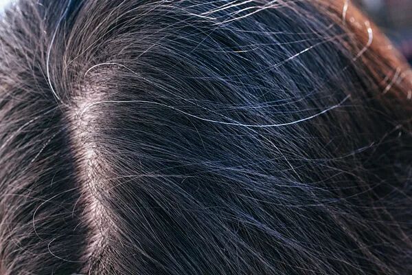 白发长在哪,病就从哪来? 但这种情况的白发或可降低肿瘤风险? 4招拥有一头秀发