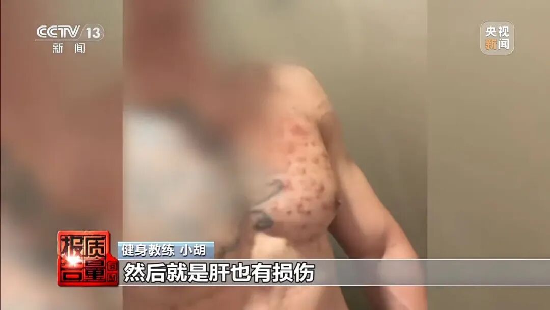 健身女孩长出喉结！部分“增肌神药”实为兽药