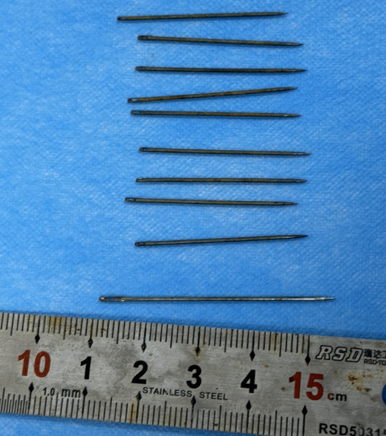 患者误吞12根绣花针，每根长4–5厘米，凉山医生施救3小时全部取出