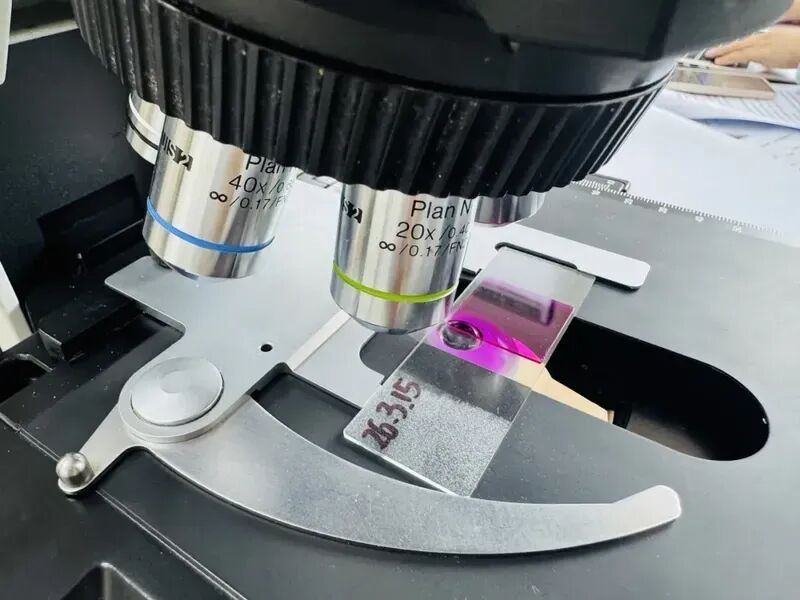 “过敏星人”注意！花粉致敏高发期，医生建议