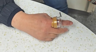 女子这样爱干净,却被紧急送医!“好习惯”用不对会“闯祸” 女子这样爱干净,却被紧急送医!“好习惯”用不对会“闯祸”