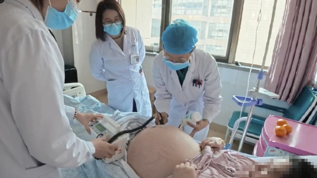 极罕见！安徽一妈妈生下三胞胎，共享一个胎盘！