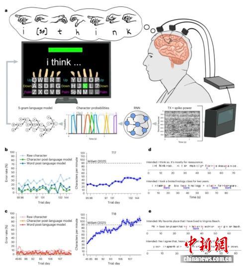 国际最新研发脑机接口打字装置 助力瘫痪患者更容易快速准确交流