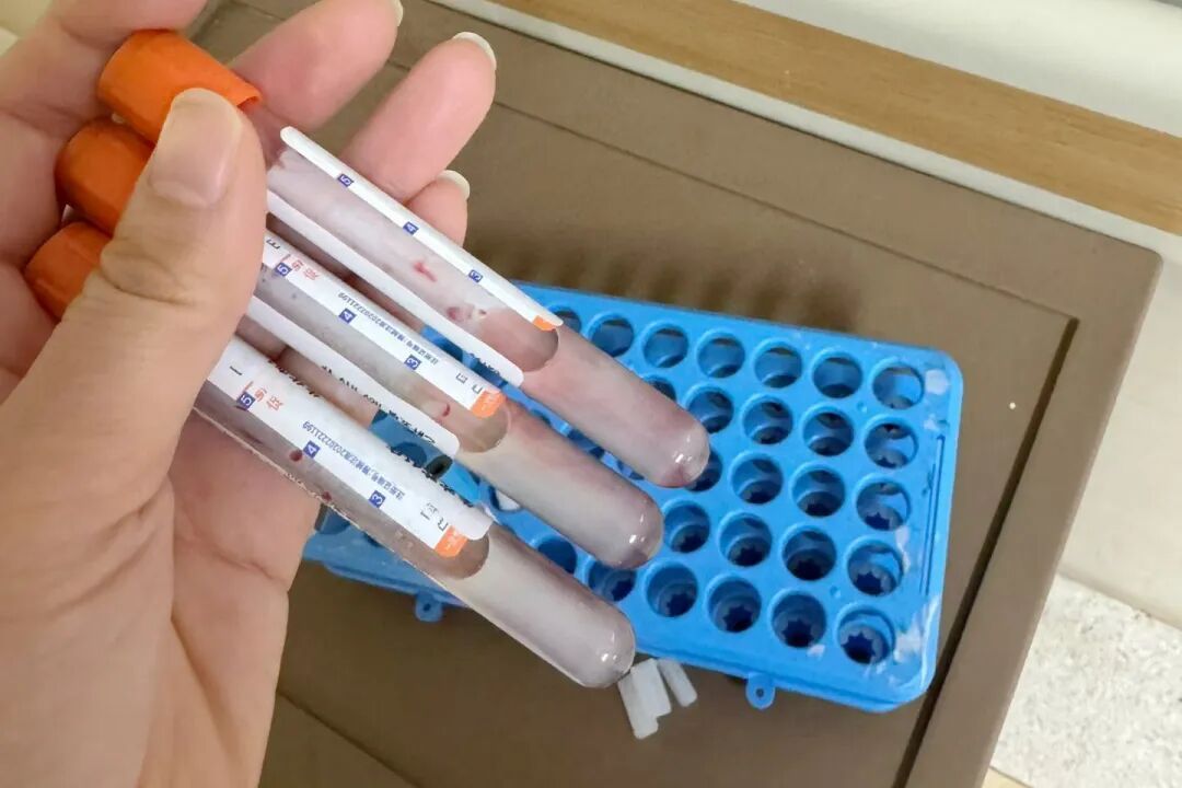 河南一女子长期吃油炸食品，抽出“牛奶血”，超标34倍