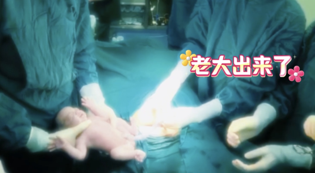 极罕见！安徽一妈妈生下三胞胎，共享一个胎盘！