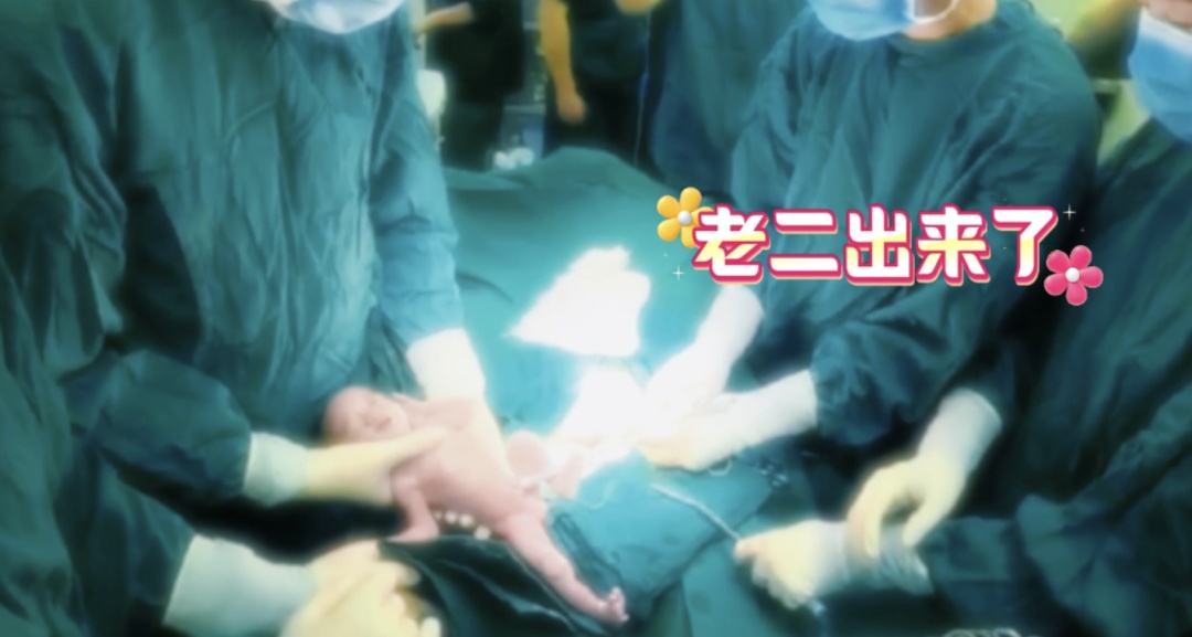 极罕见！安徽一妈妈生下三胞胎，共享一个胎盘！