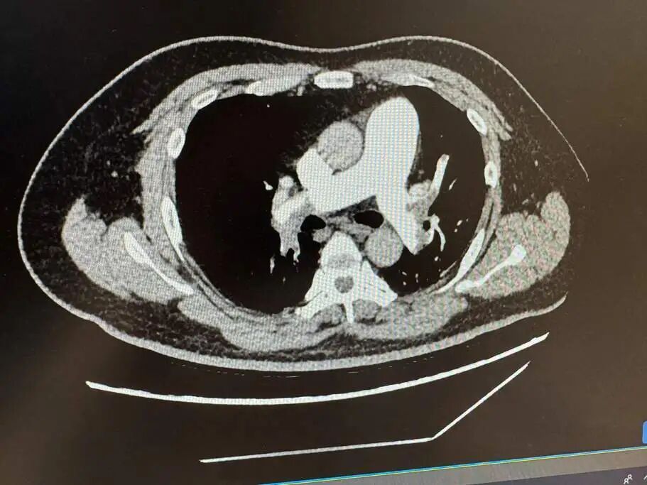 午夜惊魂！只因忽视这件事，34岁程序员险些猝死