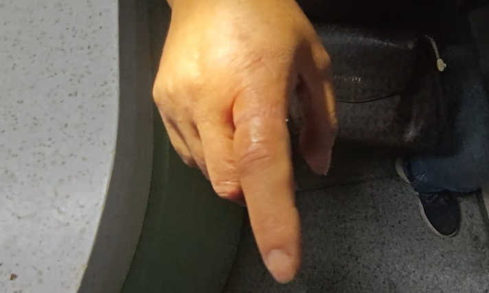 女子这样爱干净,却被紧急送医!“好习惯”用不对会“闯祸” 女子这样爱干净,却被紧急送医!“好习惯”用不对会“闯祸”