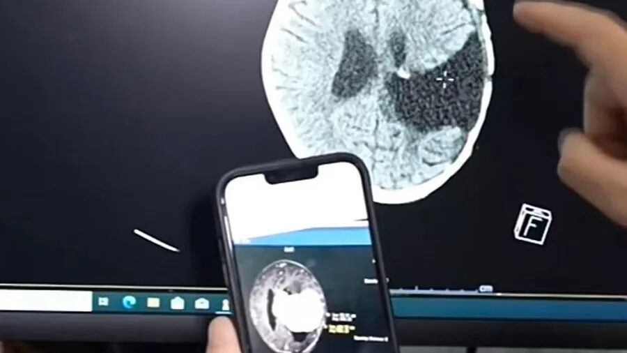 今天，她回家了！上海两家医院强强联手，5岁女孩重获新生