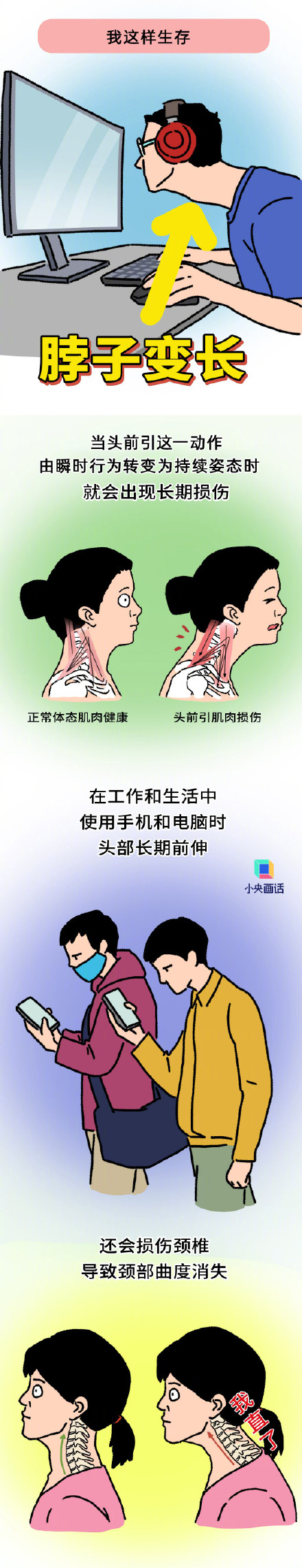 长期脖子前倾可以试试这俩动作