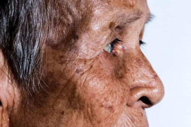 一种特别的声音，或许能影响阿尔茨海默病的大脑变化